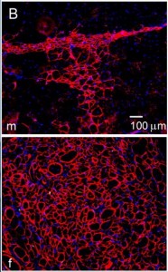 Sex and Healing of Degenerating Muscles