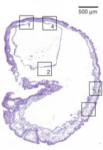 This structure has many characteristics like an embryo, but it started as a mass of in vivo-produced stem cells injected into abdomical cavity of a normal mouse. from Abad et al.